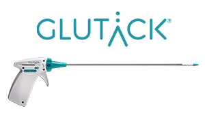 Glutack - Catéter para la fijación atraumática de prótesis herniarias