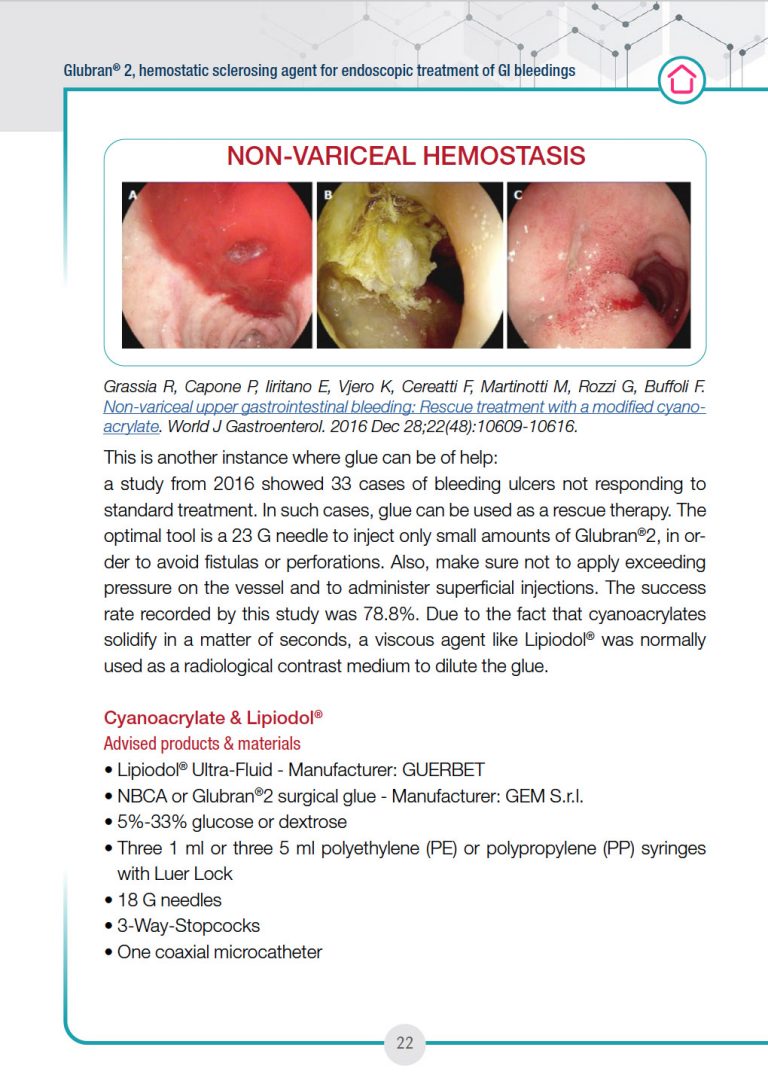The transcript of the webinar “Glubran2 hemostatic sclerosing agent” is